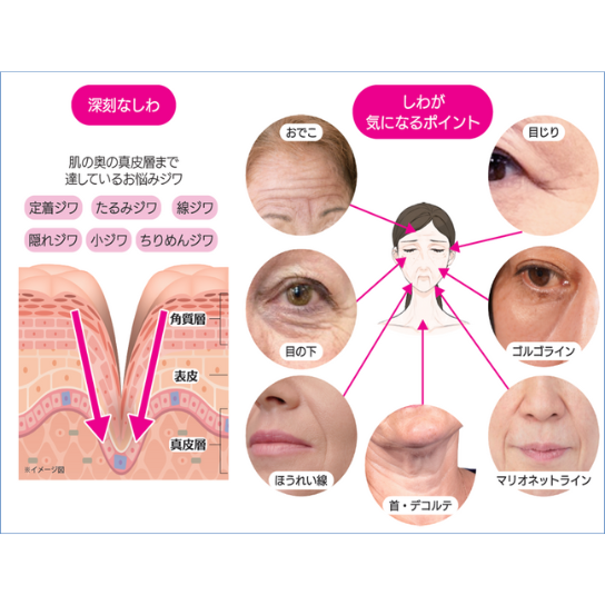 パーリーデュー薬用リンクルセラムUVミルク20g20g60gの3本セット☆日傘付 パーリーデュー シワ改善＆美白＆ 肌引き締め日中多機能 UV