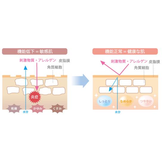 アンエラ スパモイスト エッセンス＋トライアル付きセット ※WEB限定