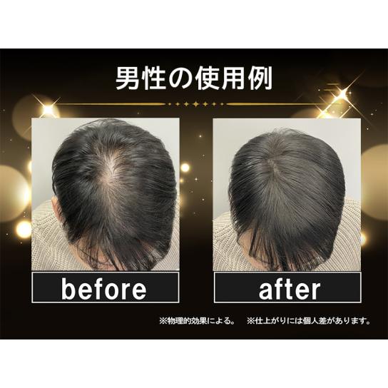 ララチュー ヘアファンデーションプレミアムN 特別セット ※1週間限定