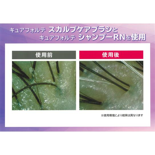 キュアフォルテ スカルプケアブラシ 1台 【送料無料】 [H260201