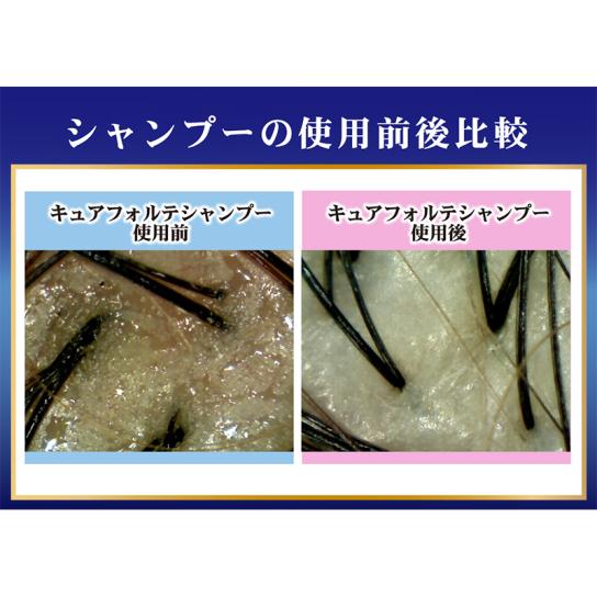 キュアフォルテ シャンプー＆トリートメント(リニューアル前) よりどり